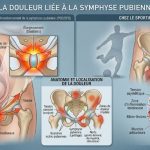 douleur symphyse pubienne